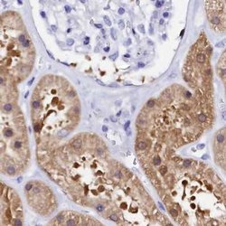 Invitrogen Sorbitol Dehydrogenase Polyclonal Antibody 100 &mu;L; Unconjugated:Antibodies,