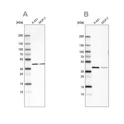 Invitrogen Sorbitol Dehydrogenase Polyclonal Antibody 100 &mu;L; Unconjugated:Antibodies,