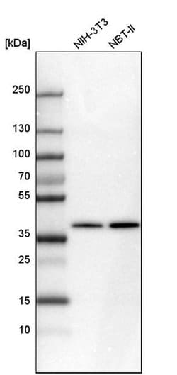 Invitrogen Sorbitol Dehydrogenase Polyclonal Antibody 100 &mu;L; Unconjugated:Antibodies,