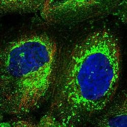 Invitrogen C18orf14 Polyclonal Antibody 100 &mu;L; Unconjugated:Antibodies,