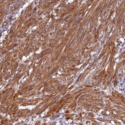 Invitrogen C18orf14 Polyclonal Antibody 100 &mu;L; Unconjugated:Antibodies,