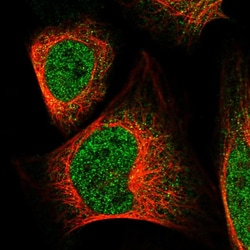 Invitrogen MAN2C1 Polyclonal Antibody 100 &mu;L; Unconjugated:Antibodies,