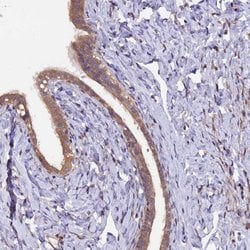 Invitrogen MAN2C1 Polyclonal Antibody 100 &mu;L; Unconjugated:Antibodies,