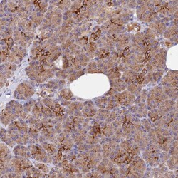 Invitrogen WDFY4 Polyclonal Antibody 100 &mu;L; Unconjugated:Antibodies,