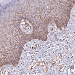 Invitrogen WDFY4 Polyclonal Antibody 100 &mu;L; Unconjugated:Antibodies,