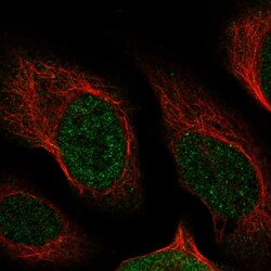 Invitrogen NUDT13 Polyclonal Antibody 100 &mu;L; Unconjugated:Antibodies,