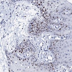 Invitrogen NUDT13 Polyclonal Antibody 100 &mu;L; Unconjugated:Antibodies,
