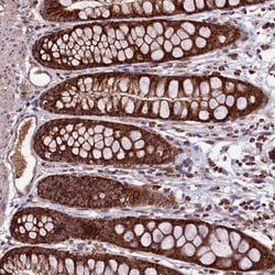 Invitrogen STARD5 Polyclonal Antibody 100 &mu;L; Unconjugated:Antibodies,