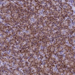 Invitrogen SLC8B1 Polyclonal Antibody 100 &mu;L | Buy Online | Invitrogen&trade; | Fisher Scientific