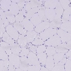 Invitrogen SLC8B1 Polyclonal Antibody 100 &mu;L | Buy Online | Invitrogen&trade; | Fisher Scientific