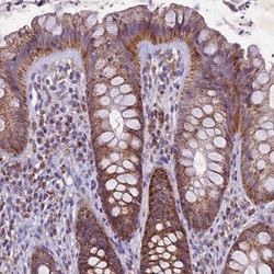 Invitrogen PMPCB Polyclonal Antibody 100 &mu;L; Unconjugated:Antibodies,