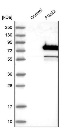 Invitrogen PGM2 Polyclonal Antibody 100 &mu;L | Buy Online | Invitrogen&trade; | Fisher Scientific