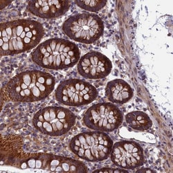 Invitrogen ACAD8 Polyclonal Antibody 100 &mu;L; Unconjugated:Antibodies,