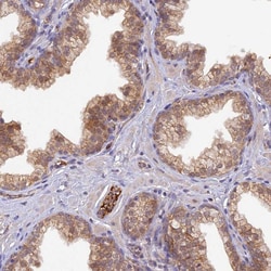 Invitrogen HDHD2 Polyclonal Antibody 100 &mu;L; Unconjugated:Antibodies,