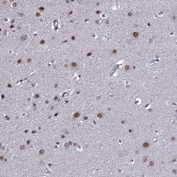 Invitrogen FAM59A Polyclonal Antibody 100 &mu;L; Unconjugated:Antibodies,