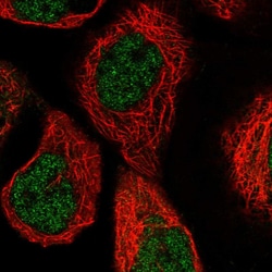 Invitrogen PGLS Polyclonal Antibody 100 &mu;L; Unconjugated:Antibodies,