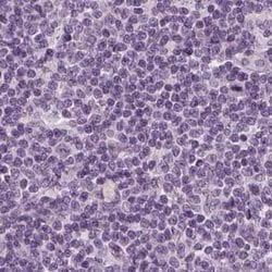 Invitrogen Filensin Polyclonal Antibody 100 &mu;L; Unconjugated:Antibodies,