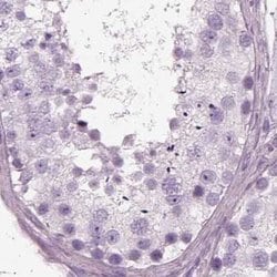 Invitrogen Filensin Polyclonal Antibody 100 &mu;L; Unconjugated:Antibodies,