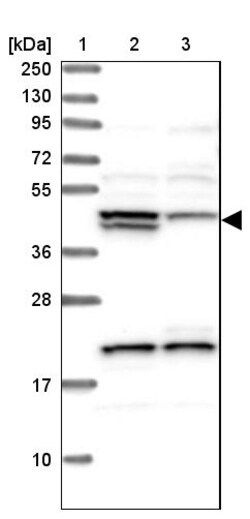 Invitrogen HERPUD1 Polyclonal Antibody 100 &mu;L; Unconjugated:Antibodies,