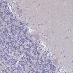 Invitrogen LOC81691 Polyclonal Antibody 100 &mu;L; Unconjugated:Antibodies,