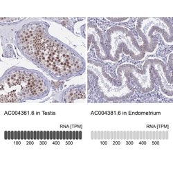 Invitrogen LOC81691 Polyclonal Antibody 100 &mu;L; Unconjugated:Antibodies,