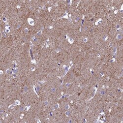Invitrogen SV2C Polyclonal Antibody 100 &mu;L; Unconjugated:Antibodies,