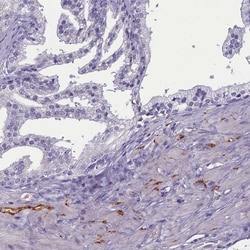 Invitrogen SV2C Polyclonal Antibody 100 &mu;L; Unconjugated:Antibodies,