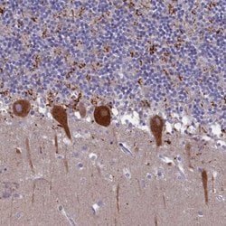 Invitrogen SV2C Polyclonal Antibody 100 &mu;L; Unconjugated:Antibodies,