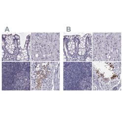 Invitrogen FAM71B Polyclonal Antibody 100 &mu;L; Unconjugated:Antibodies,