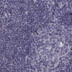 Invitrogen FAM71B Polyclonal Antibody 100 &mu;L; Unconjugated:Antibodies,