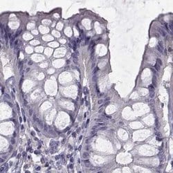 Invitrogen FAM71B Polyclonal Antibody 100 &mu;L; Unconjugated:Antibodies,