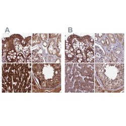 Invitrogen RCCD1 Polyclonal Antibody 100 &mu;L; Unconjugated:Antibodies,