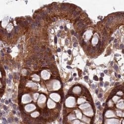 Invitrogen RCCD1 Polyclonal Antibody 100 &mu;L; Unconjugated:Antibodies,