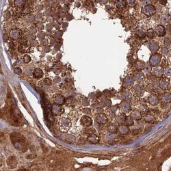 Invitrogen RCCD1 Polyclonal Antibody 100 &mu;L; Unconjugated:Antibodies,