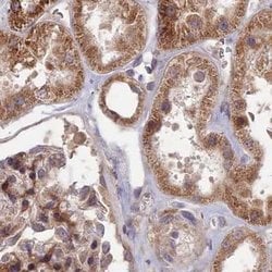 Invitrogen RCCD1 Polyclonal Antibody 100 &mu;L; Unconjugated:Antibodies,
