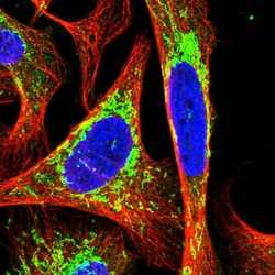 Invitrogen DLAT Polyclonal Antibody 100 &mu;L; Unconjugated:Antibodies,