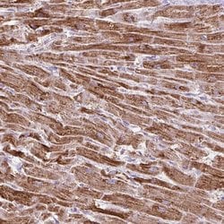 Invitrogen DLAT Polyclonal Antibody 100 &mu;L; Unconjugated:Antibodies,