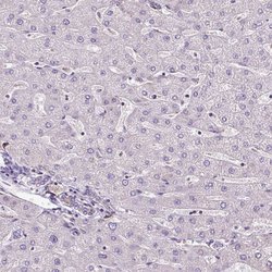 Invitrogen DLAT Polyclonal Antibody 100 &mu;L; Unconjugated:Antibodies,