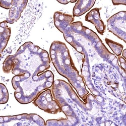 Invitrogen ANKRD32 Polyclonal Antibody 100 &mu;L; Unconjugated:Antibodies,
