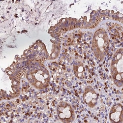 Invitrogen METTL22 Polyclonal Antibody 100 &mu;L; Unconjugated:Antibodies,