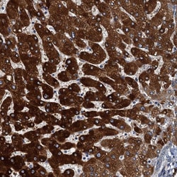 Invitrogen ZC3H7A Polyclonal Antibody 100 &mu;L; Unconjugated:Antibodies,