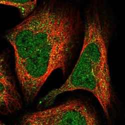 Invitrogen RBFOX1 Polyclonal Antibody 100 &mu;L; Unconjugated:Antibodies,