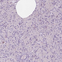 Invitrogen RBFOX1 Polyclonal Antibody 100 &mu;L; Unconjugated:Antibodies,