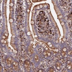Invitrogen PPP2R3C Polyclonal Antibody 100 &mu;L | Buy Online | Invitrogen&trade; | Fisher Scientific