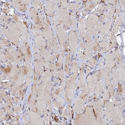 Invitrogen PPP2R3C Polyclonal Antibody 100 &mu;L | Buy Online | Invitrogen&trade; | Fisher Scientific