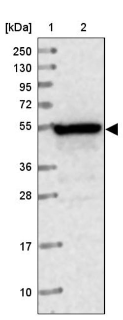 Invitrogen PPP2R3C Polyclonal Antibody 100 &mu;L | Buy Online | Invitrogen&trade; | Fisher Scientific