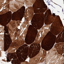 Invitrogen ANKRD2 Polyclonal Antibody 100 &mu;L | Buy Online | Invitrogen&trade; | Fisher Scientific