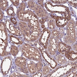 Invitrogen NARFL Polyclonal Antibody 100 &mu;L; Unconjugated:Antibodies,