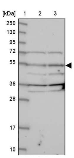 Invitrogen NARFL Polyclonal Antibody 100 &mu;L | Buy Online | Invitrogen&trade; | Fisher Scientific