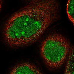 Invitrogen TGDS Polyclonal Antibody 100 &mu;L; Unconjugated:Antibodies,